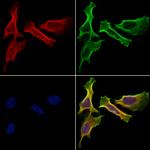 HHIP Antibody in Immunocytochemistry (ICC/IF)