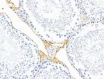 HHIP Antibody in Immunohistochemistry (Paraffin) (IHC (P))