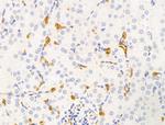 HHIP Antibody in Immunohistochemistry (Paraffin) (IHC (P))