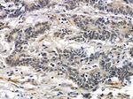 HIPK1 Antibody in Immunohistochemistry (Paraffin) (IHC (P))