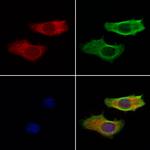 Hippocalcin Antibody in Immunocytochemistry (ICC/IF)