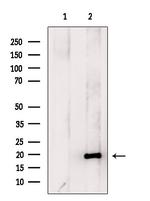 Hippocalcin Antibody in Western Blot (WB)