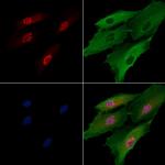 HLTF Antibody in Immunocytochemistry (ICC/IF)