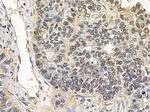 HMBOX1 Antibody in Immunohistochemistry (Paraffin) (IHC (P))