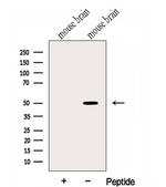 HMBOX1 Antibody in Western Blot (WB)