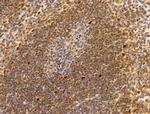 HMGA1 Antibody in Immunohistochemistry (Paraffin) (IHC (P))