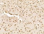 HMGA1 Antibody in Immunohistochemistry (Paraffin) (IHC (P))