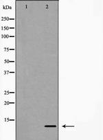 HMGA1 Antibody in Western Blot (WB)