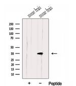 HMGCL Antibody in Western Blot (WB)