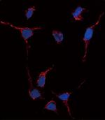 ALDH1A1 Antibody in Immunocytochemistry (ICC/IF)