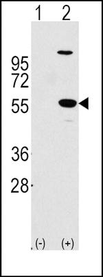 ALDH1A1 Antibody in Western Blot (WB)