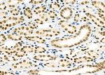 PCBP1 Antibody in Immunohistochemistry (Paraffin) (IHC (P))