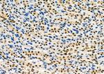 PCBP1 Antibody in Immunohistochemistry (Paraffin) (IHC (P))