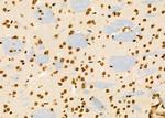 PCBP1 Antibody in Immunohistochemistry (Paraffin) (IHC (P))