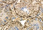 PCBP1 Antibody in Immunohistochemistry (Paraffin) (IHC (P))