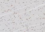 hnRNP K Antibody in Immunohistochemistry (Paraffin) (IHC (P))