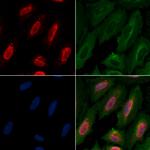 HP1 gamma Antibody in Immunocytochemistry (ICC/IF)