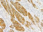 HRH2 Antibody in Immunohistochemistry (Paraffin) (IHC (P))