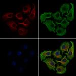 HSD17B1 Antibody in Immunocytochemistry (ICC/IF)