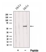 HYAL2 Antibody in Western Blot (WB)