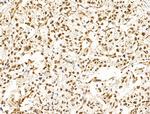 HAS2 Antibody in Immunohistochemistry (Paraffin) (IHC (P))