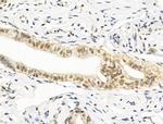 HAS2 Antibody in Immunohistochemistry (Paraffin) (IHC (P))