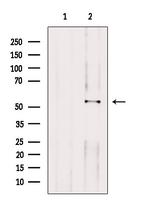 HAS2 Antibody in Western Blot (WB)