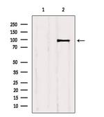 IR/IGF1R Antibody in Western Blot (WB)