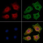 IL-22 Receptor alpha Antibody in Immunocytochemistry (ICC/IF)