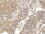 IL-22 Receptor alpha Antibody in Immunohistochemistry (Paraffin) (IHC (P))