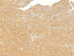 IL-22 Receptor alpha Antibody in Immunohistochemistry (Paraffin) (IHC (P))