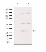 IL-4 Antibody in Western Blot (WB)