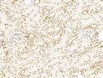 ILF1 Antibody in Immunohistochemistry (Paraffin) (IHC (P))