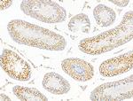 ILF1 Antibody in Immunohistochemistry (Paraffin) (IHC (P))