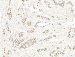 ILF1 Antibody in Immunohistochemistry (Paraffin) (IHC (P))