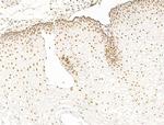 ILF1 Antibody in Immunohistochemistry (Paraffin) (IHC (P))