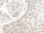 ILF1 Antibody in Immunohistochemistry (Paraffin) (IHC (P))