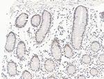 ILF1 Antibody in Immunohistochemistry (Paraffin) (IHC (P))