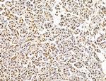 ILF1 Antibody in Immunohistochemistry (Paraffin) (IHC (P))