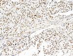 ILF1 Antibody in Immunohistochemistry (Paraffin) (IHC (P))