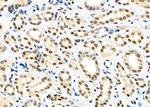 ILF3 Antibody in Immunohistochemistry (Paraffin) (IHC (P))