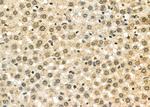 ILF3 Antibody in Immunohistochemistry (Paraffin) (IHC (P))