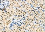 ILF3 Antibody in Immunohistochemistry (Paraffin) (IHC (P))