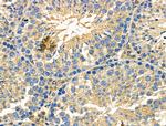 ILK Antibody in Immunohistochemistry (Paraffin) (IHC (P))