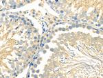 ILK Antibody in Immunohistochemistry (Paraffin) (IHC (P))