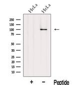 Importin beta-1 Antibody in Western Blot (WB)