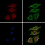 INSR Antibody in Immunocytochemistry (ICC/IF)