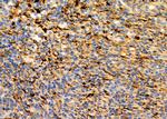 IFN alpha Antibody in Immunohistochemistry (Paraffin) (IHC (P))