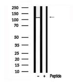 ERN1/ERN2 Antibody in Western Blot (WB)