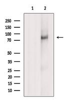 CD18 Antibody in Western Blot (WB)